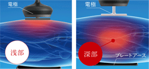 カイロプラクティック福住　ラジオ波残部深部